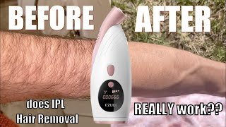 IPL Hair Removal (My 8 Week Experiment & Results) screenshot 4