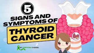 5 Important Signs and Symptoms of Thyroid Cancer That You Shouldn't Ignore