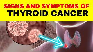 5 Important Signs and Symptoms of Thyroid Cancer That You Shouldn't Ignore