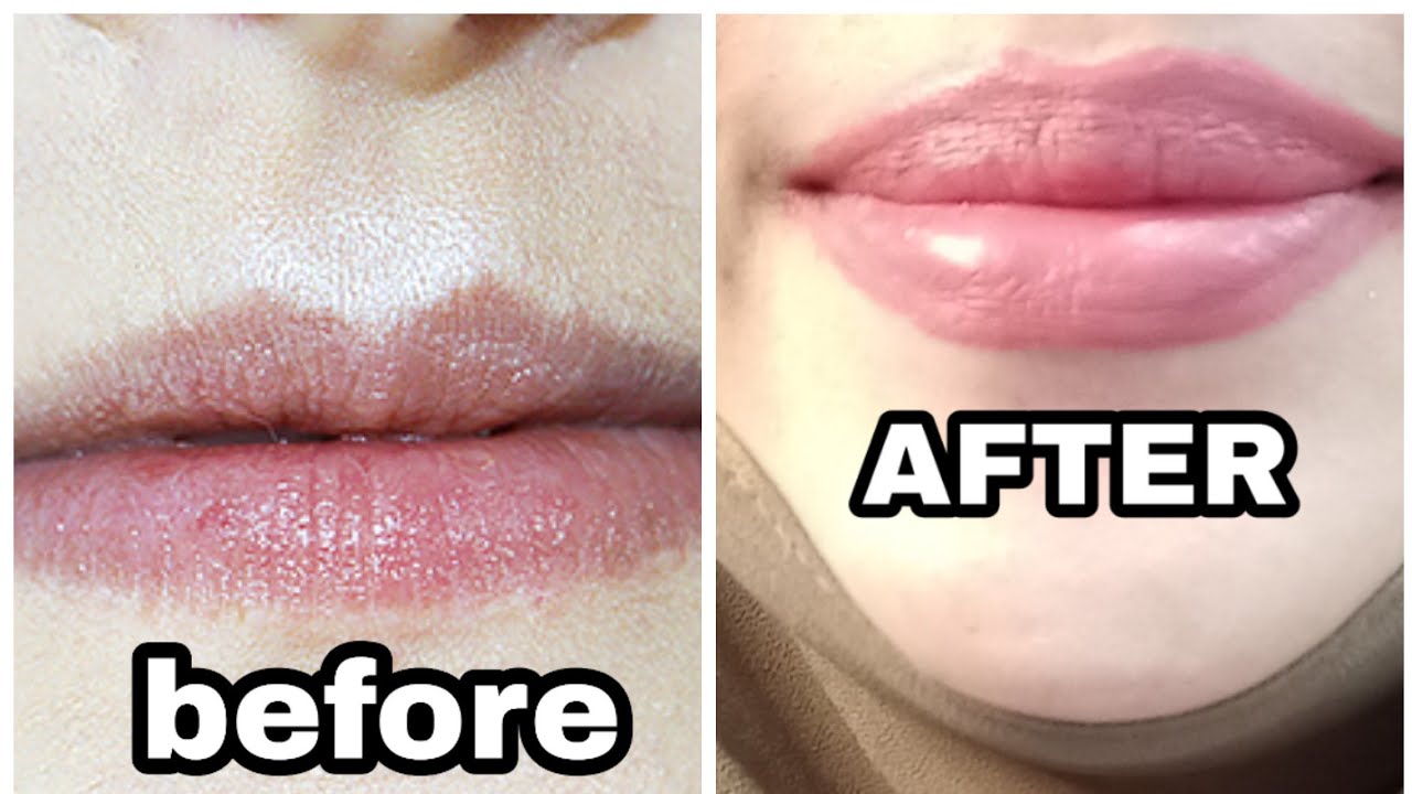 HOW TO GET BIGGER LIPS ( BEGINNER) 2 PRODUCT ONLY - YouTube