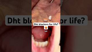How long should you take DHT-Blocker after your hair transplant? #hairtransplant #hairlosstreatment
