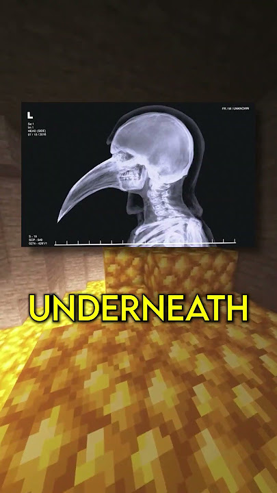 SCP Shower Thoughts… #93