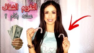 كل حاجه عن التقويم الشفاف.. سعره / مدته / مميزاته / عيوبه / شكله all about my Invisalign✨🦷