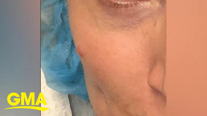 Woman diagnosed with cancer after finding bump on ...
