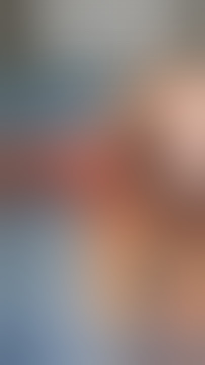 Penile enlargement surgery results after surgery by Dr Araz Bayramov #andrologist #penis