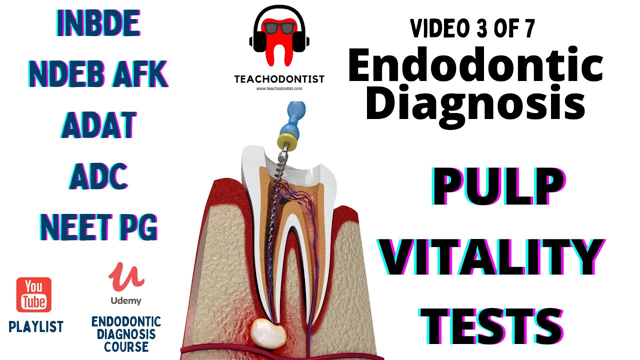 ENDODONTIC DIAGNOSIS COURSE part 3/7 PULP VITALITY TESTS iNBDE