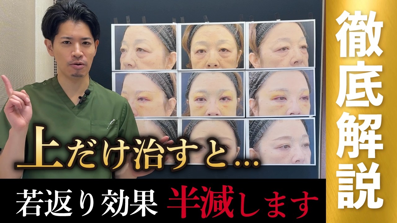 目元タルミは上下まとめて治療すべきです　症例解説 part.3 ＃眉下リフト　＃眉下切開　#ジェントル滝澤