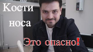 Горбинка на носу. Опасно ли трогать кости носа?(, 2018-08-11T17:39:30.000Z)