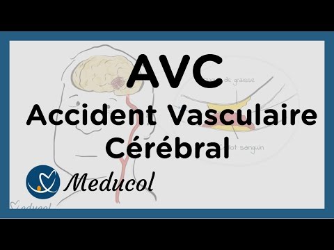 Vidéo: Infarctus Cérébral: Qu'est-ce Que C'est, Conséquences, Symptômes, Causes