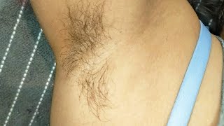 Armpit Waxing With Milkywaxunderarms Waxing