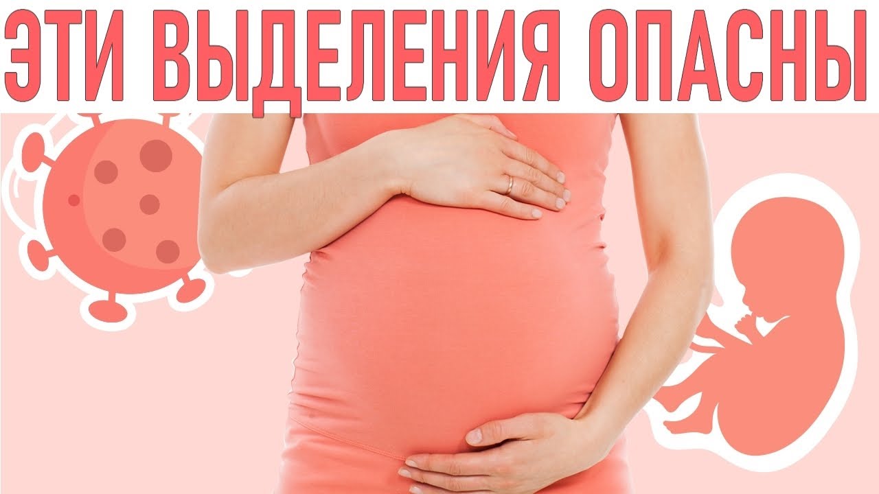 ВЫДЕЛЕНИЯ ВО ВРЕМЯ БЕРЕМЕННОСТИ | Что они означают причины, цвет, лечение