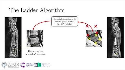 The Ladder Algorithm - Finding Repetitive Structures in Medical Images by Induction (ISBI 2020)
