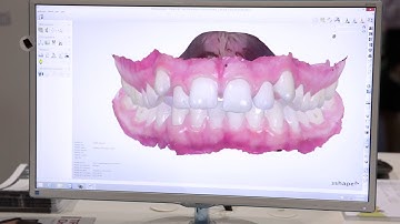 Live demo at AAO  3Shape Ortho System software