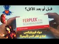 FERPLEX | معلومات حول دواء فيربليكس