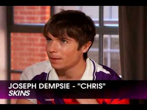 SKINS (BBC America) - Cast weighs in on...Tony