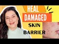 How to Heal damaged skin barrier,get rid of pigmentation