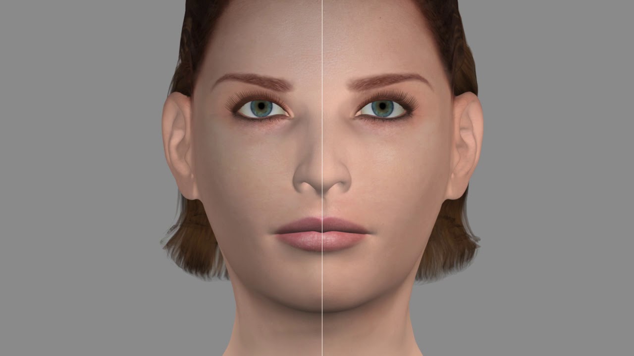 Le vieillissement du visage - Dr Alain Elbaz