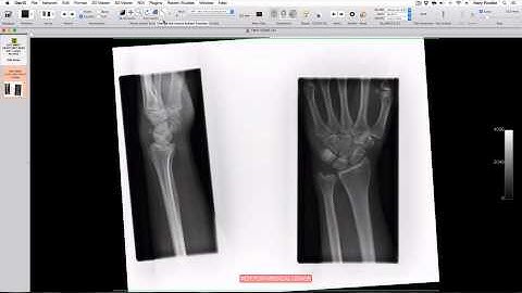 How to optimise teaching images imported into OsiriX Lite