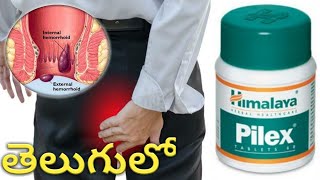 Piles and fissure treatment in allopathic (harsh molalu) modern medicine in Telugu