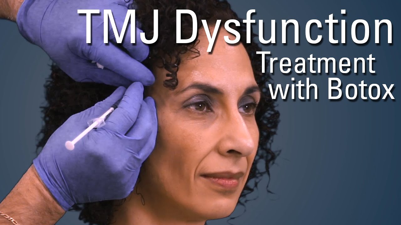 How Long For Botox To Work For Tmj : Beyond Wrinkles — Why Botox Works