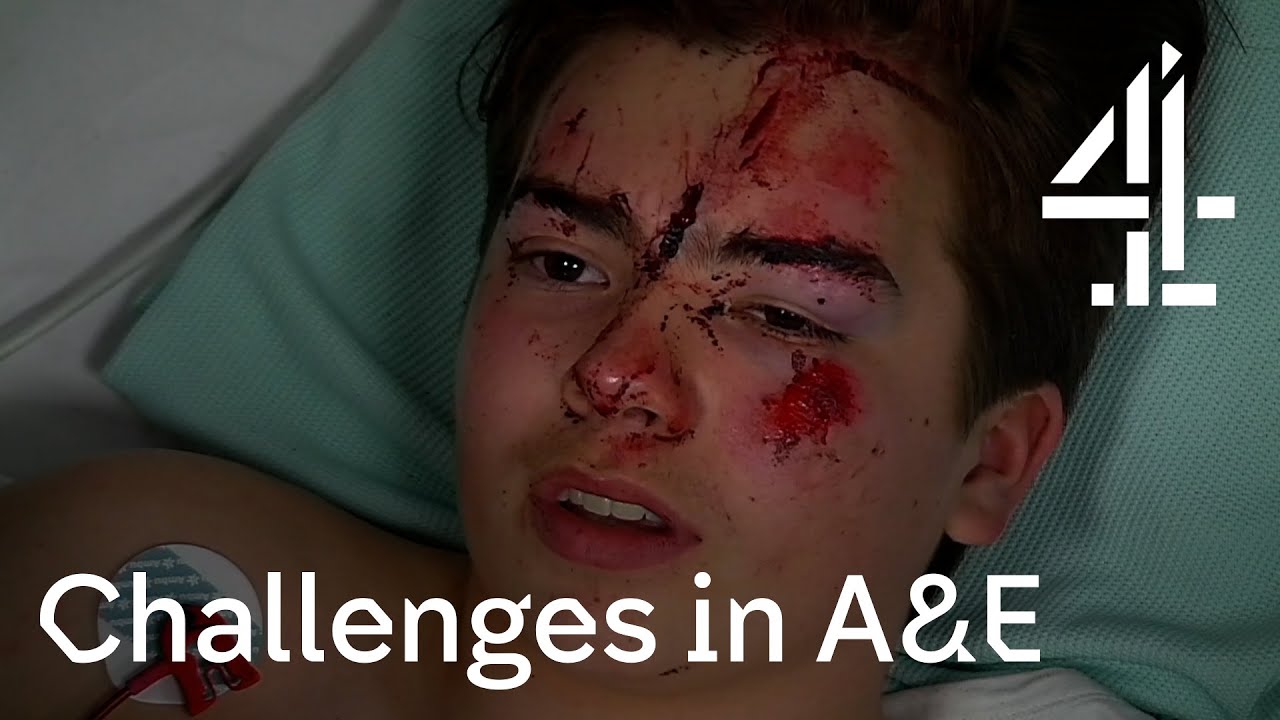 Download 24 Hours in A&E | Dealing With A Serious Head Injury