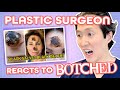 Plastic Surgeon Reacts to BOTCHED - Alternative Cancer Treatment Destroys Nose - Dr. Anthony Youn