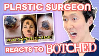 Plastic Surgeon Reacts to BOTCHED: DIY Cancer Treatment Destroys Nose!