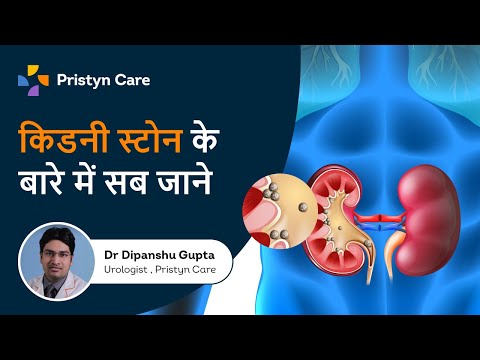 किडनी स्टोन के बारे में सब जाने | Pristyn Care