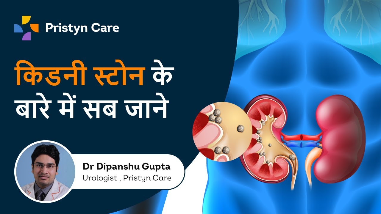 किडनी स्टोन के बारे में सब जाने | Pristyn Care