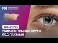 Убираем темные круги под глазами