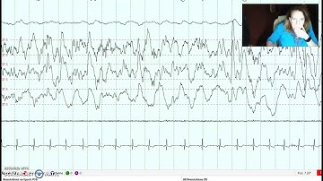 Overview of AASM ISR