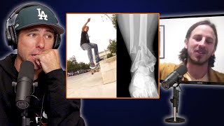 Riley Hawk Broke His Ankle In Milan Trying To Re-Film A Trick Profile