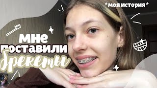 мне поставили брекеты 🦷// вся правда и моя история