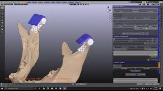 ZOOM Session - Articulator
