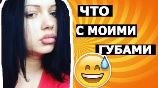 МОЯ НЕУДАЧНАЯ ПЛАСТИКА ГУБ /// НЕНАДО ТАК!!!