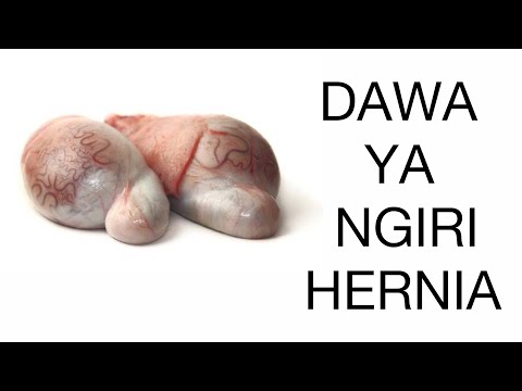 TIBA YA ASILI YA NGIRI-HERNIA +255656302000