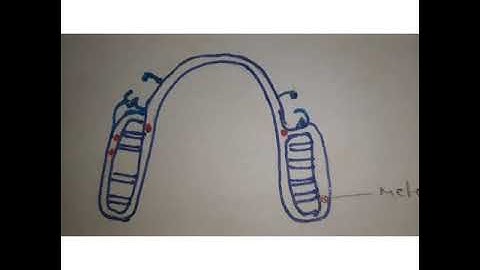 Metal Try in of Cast Metal Framework