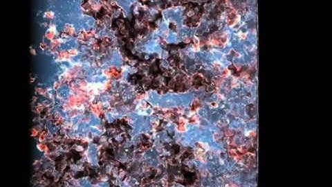 Simulation of the Reionization of the Universe