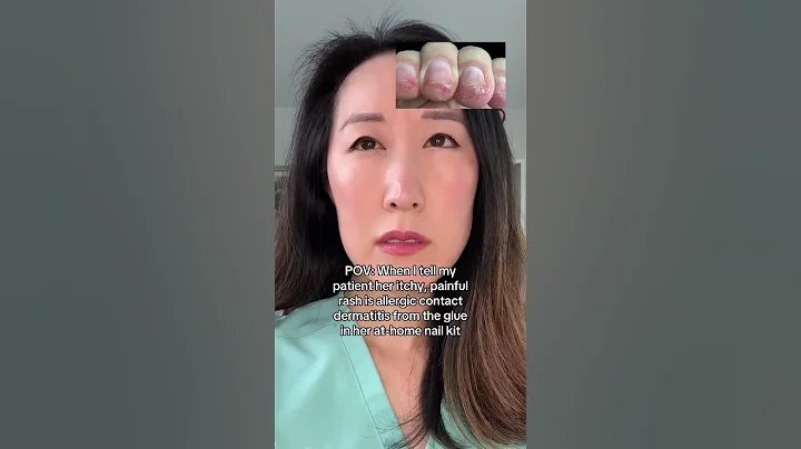 Allergic Reaction from Your Nail Kit?