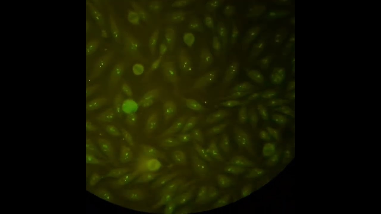 immunofluorescence test: Antibodies against U3-nRNP/fibrillarin for detection systemic sclerosis.
