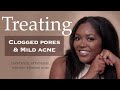 Treating Mild Acne & Clogged Pores w/ Esthetician, LABeautyolologist