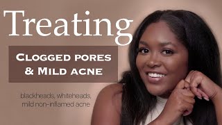 Treating Mild Acne & Clogged Pores w/ Esthetician, LABeautyolologist