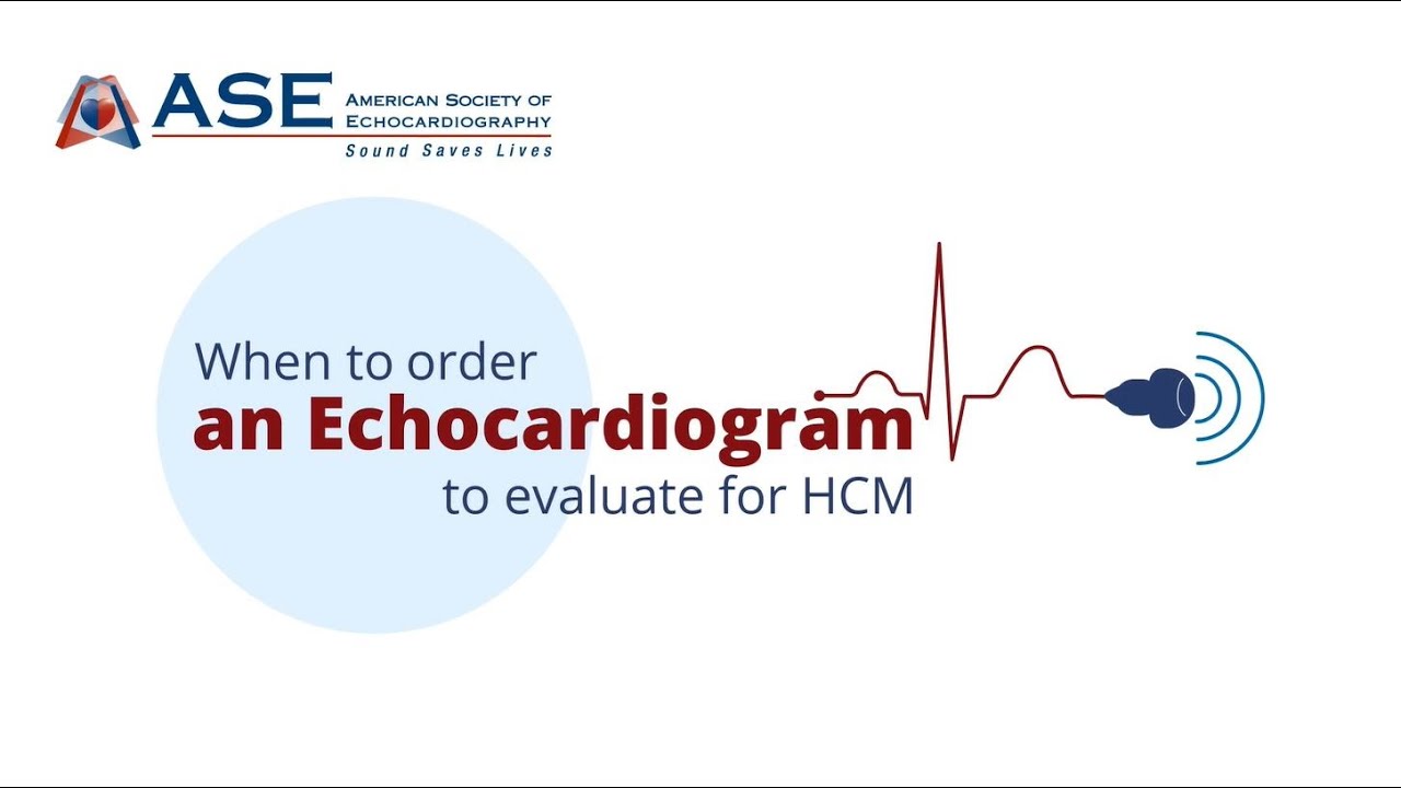 When to Order an Echocardiogram to Evaluate for HCM - YouTube