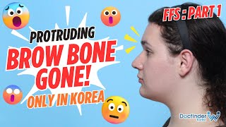 Facial Feminization Surgery in Korea: Dream Come True or Regret P1. | Male to Female Transformation