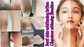 Glupatone whitening Emulsion/ most viral full body whitening lotion |Samra Rukhsar