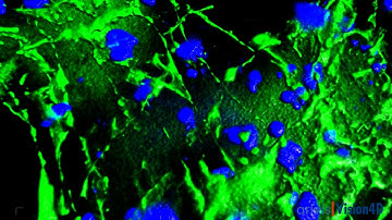 Deconvolved Widefield Z-stack from Etaluma LS720 of AIM Biotech 3D culture