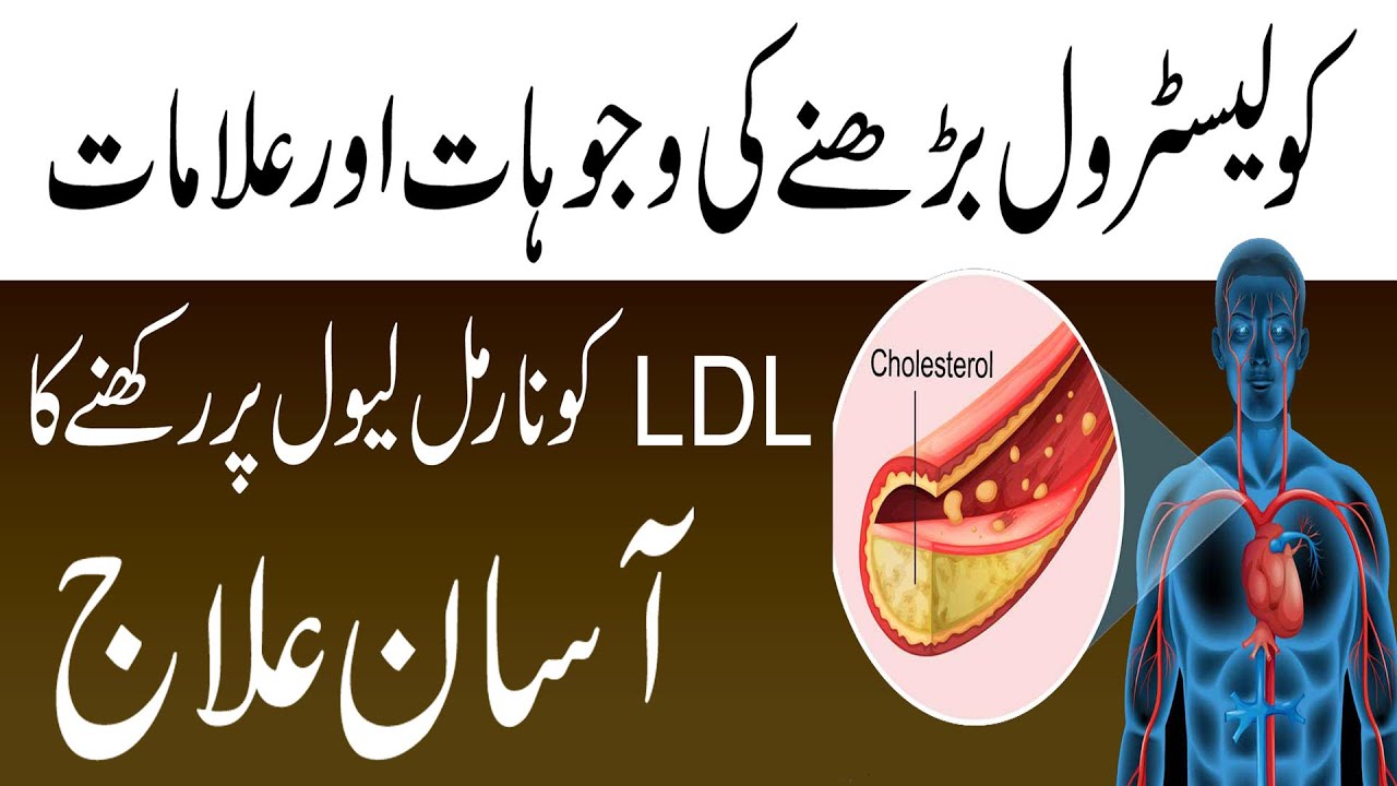 Cholesterol Kam Karne Ka Tarika Ilaj Control High Cholesterol Signs