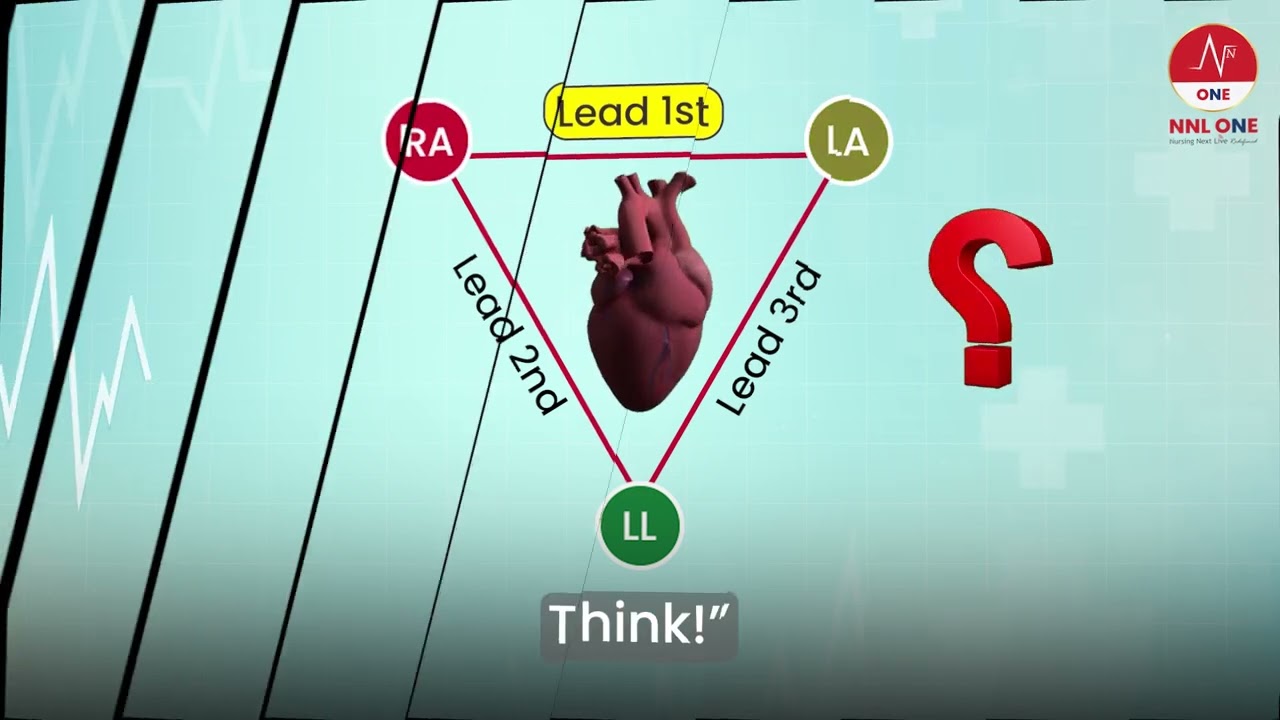 ECG Basics: Which Electrode is Positive in Lead I? (Einthoven’s Triangle) | NNL ONE