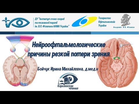 Видео: Потеря периферического зрения: причины, лечение и многое другое