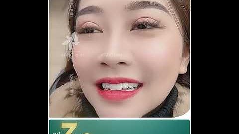 THẨM MỸ RĂNG SỨ - KIẾN TẠO NỤ CƯỜI